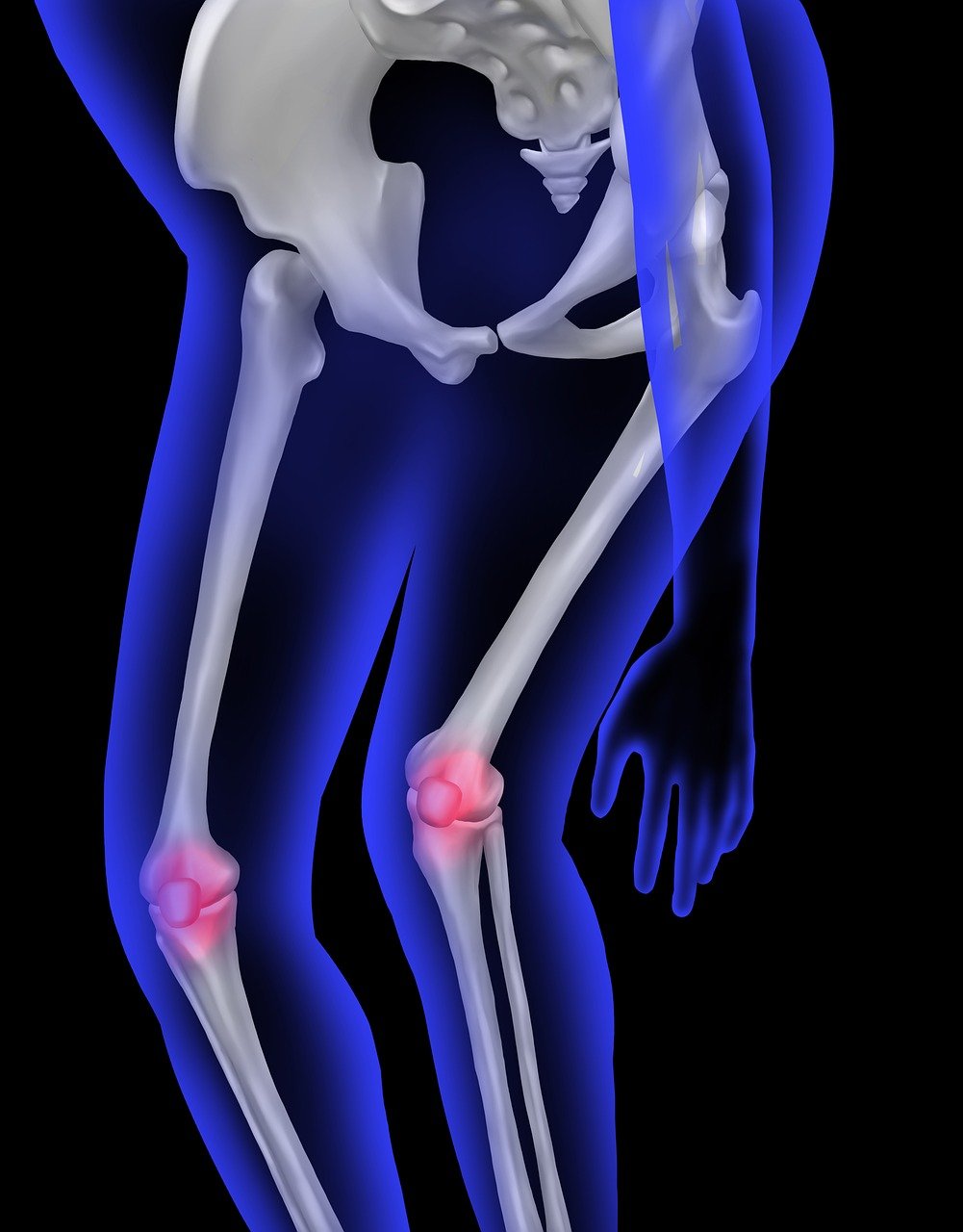 entdecken sie individuell angepasste orthopädische einlagen, die komfort und unterstützung bieten. unsere maßgeschneiderten einlegesohlen fördern fußgesundheit und wohlbefinden im alltag.