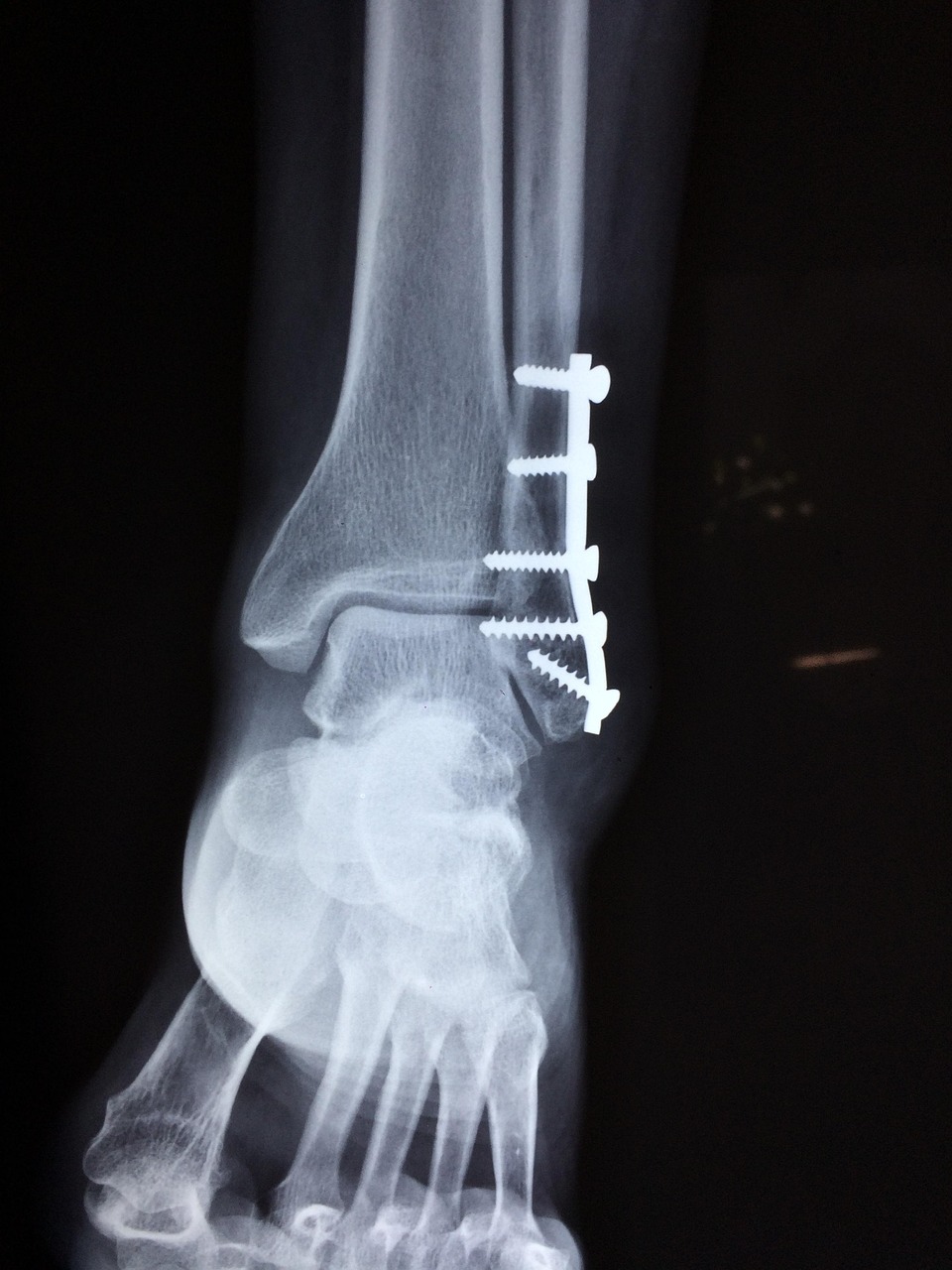 entdecken sie die moderne orthopädische medizin in deutschland: innovative behandlungen, präzise diagnosen und individuell angepasste therapien für ihre gesundheit und mobilität.