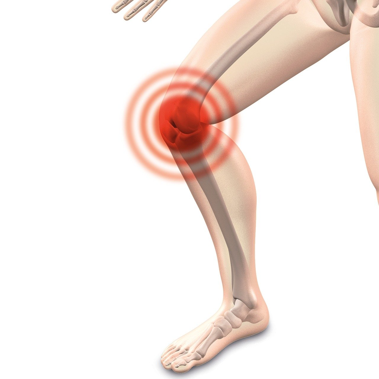 erfahren sie alles über osteoarthritis: ursachen, symptome, diagnose und moderne behandlungsmöglichkeiten, um gelenkschmerzen effektiv zu lindern und ihre beweglichkeit zu verbessern.