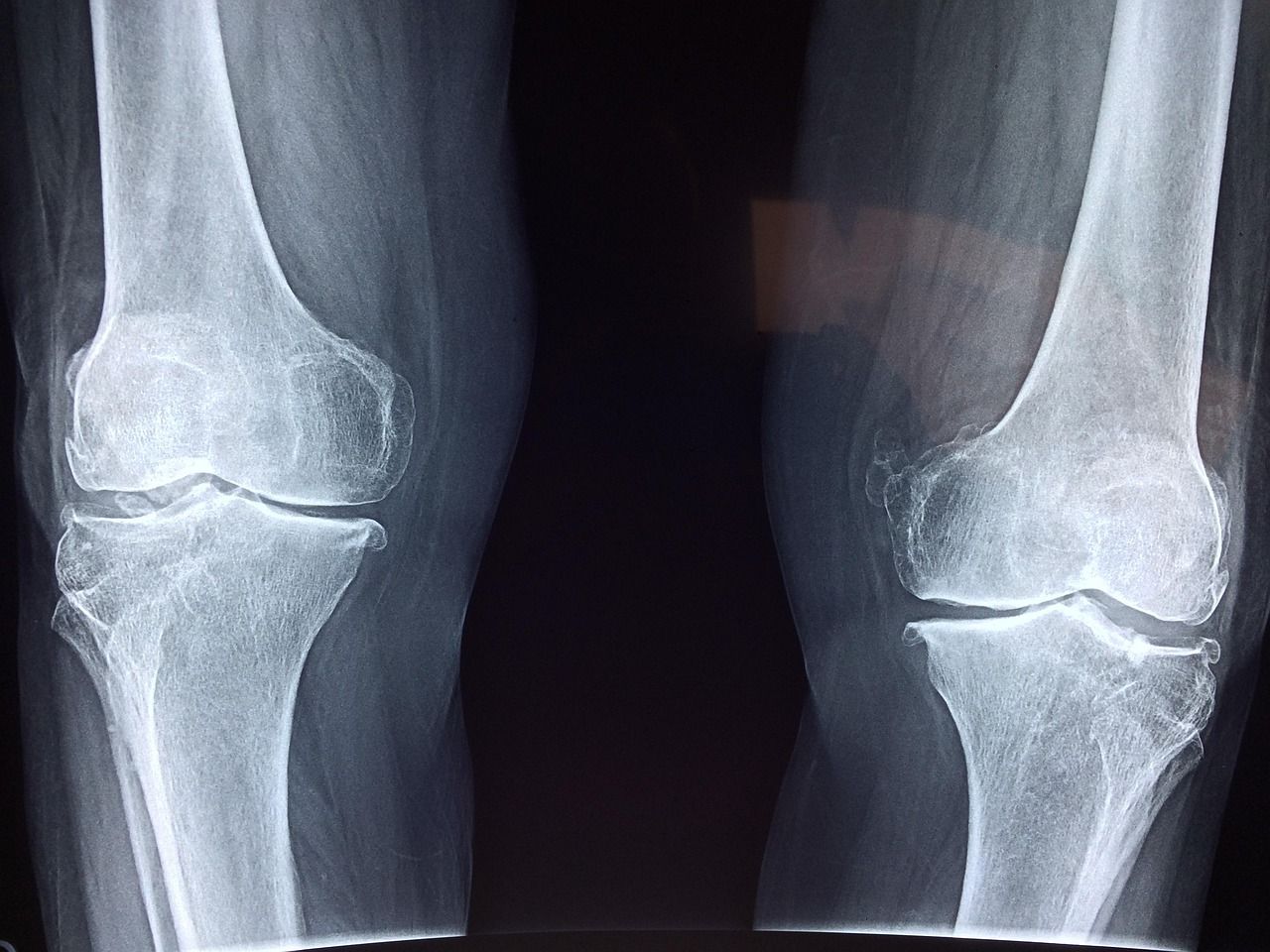 entdecken sie die neuesten informationen und behandlungen aus dem bereich der orthopädie. alles zu diagnosen, therapien und prävention von erkrankungen des bewegungsapparates – für ihre gesundheit und mobilität.